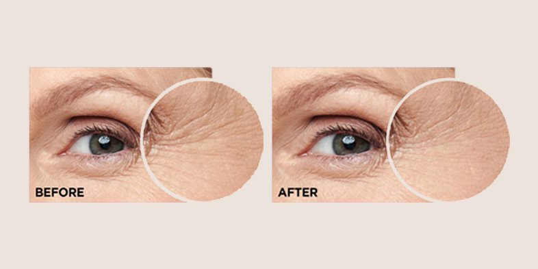 In Article Dry Skin Rules To Follow HASerum